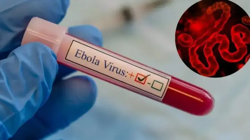 Францияда Эбола вирусын жұқтырудың алғашқы жағдайы тіркелді